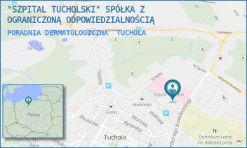 PORADNIA DERMATOLOGICZNA - "SZPITAL TUCHOLSKI" SPÓŁKA Z OGRANICZONĄ ODPOWIEDZIALNOŚCIĄ - NOWODWORSKIEGO 14-18,  TUCHOLA