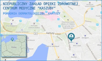 PORADNIA DERMATOLOGICZNA - NIEPUBLICZNY ZAKŁAD OPIEKI ZDROWOTNEJ CENTRUM MEDYCZNE "KASZUBY" - UL. DWORCOWA 2,  KARTUZY