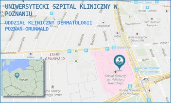 ODDZIAŁ KLINICZNY DERMATOLOGII - UNIWERSYTECKI SZPITAL KLINICZNY W POZNANIU - PRZYBYSZEWSKIEGO 49,  POZNAŃ-GRUNWALD